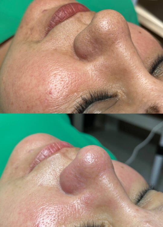 lux-glow-guzellik-salonu-cilt-bakimi-1