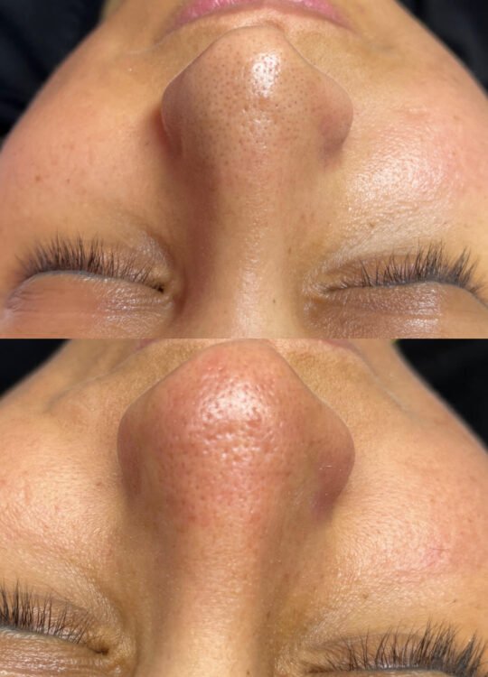 lux-glow-guzellik-salonu-cilt-bakimi-2