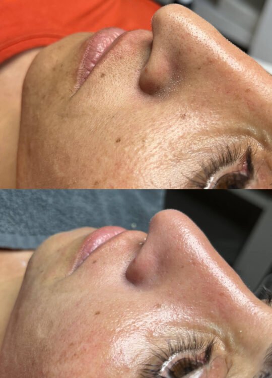 lux-glow-guzellik-salonu-cilt-bakimi-3