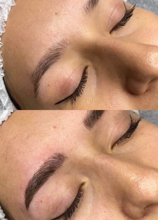 mikrobladin-burdur-3